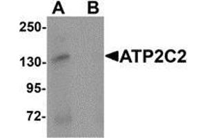 Western blot analysis of ATP2C2 in 3T3 cell lysate with ATP2C2 antibody at 1 μg/ml in (A) the absence and (B) the presence of blocking peptide (ATP2C2 antibody  (N-Term))