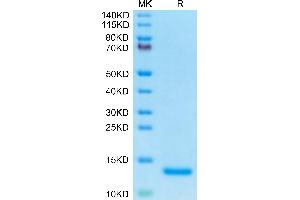 Human C5a on Tris-Bis PAGE under reduced condition. (C5A Protein (AA 678-751) (His tag))