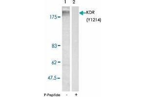 Western blot analysis of extracts from SK-OV-3 cells using KDR (phospho Y1214) polyclonal antibody . (VEGFR2/CD309 antibody  (pTyr1214))