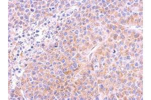 Image no. 1 for anti-Tubulin, beta (TUBB) (AA 160-447) antibody (ABIN1501915) (TUBB antibody  (AA 160-447))