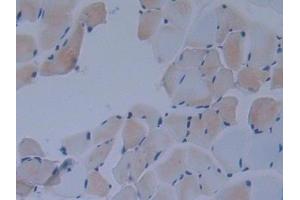 Detection of IkBd in Mouse Skeletal muscle Tissue using Polyclonal Antibody to Inhibitory Subunit Of NF Kappa B Delta (IkBd) (IkBd antibody  (AA 58-304))