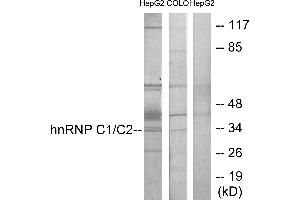 Immunohistochemistry analysis of paraffin-embedded human brain tissue using hnRNP C1/C2 antibody.