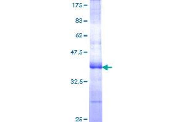 TFPI Protein (AA 152-251) (GST tag)