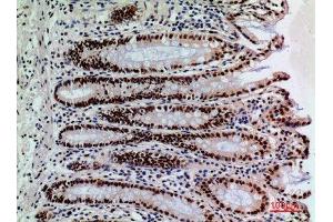 Immunohistochemistry (IHC) analysis of paraffin-embedded Human Colon, antibody was diluted at 1:100. (SLAMF1 antibody  (Tyr1096))