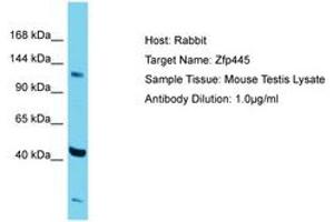 Image no. 1 for anti-Zinc Finger Protein 445 (ZNF445) (AA 406-455) antibody (ABIN6750286)