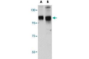 Western blot analysis of SH3BP4 in rat lung tissue lysate with SH3BP4 polyclonal antibody  at (A) 1 and (B) 2 ug/mL . (SH3BP4 antibody  (C-Term))
