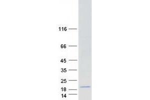 Validation with Western Blot (G0S2 Protein (Myc-DYKDDDDK Tag))