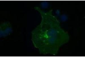 Image no. 7 for anti-Fc gamma RII (CD32) antibody (ABIN1497255) (Fc gamma RII (CD32) antibody)