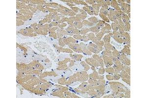 Immunohistochemistry of paraffin-embedded Rat heart using CAST Polyclonal Antibody at dilution of 1:100 (40x lens). (Calpastatin antibody)