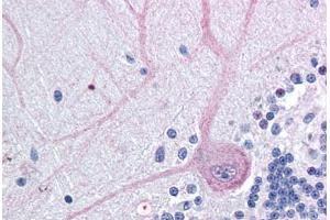 anti-BCL2-Associated Athanogene 4 (BAG4) (N-Term) antibody