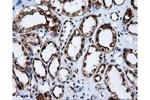 Immunohistochemical staining of paraffin-embedded liver tissue using anti-APP mouse monoclonal antibody. (APP antibody)