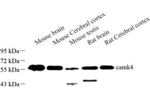 Western blot analysis of camk4 (ABIN7073281) at dilution of 1: 500 (CAMK4 antibody)