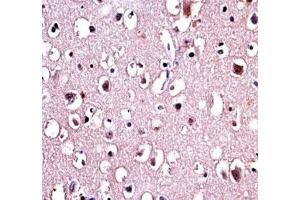 Immunohistochemistry (IHC) image for anti-Parkinson Protein 2, E3 Ubiquitin Protein Ligase (Parkin) (PARK2) (AA 111-140) antibody (ABIN3032153)