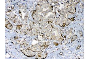 IHC analysis of GAD65 using anti-GAD65 antibody . (GAD65 antibody  (AA 84-182))