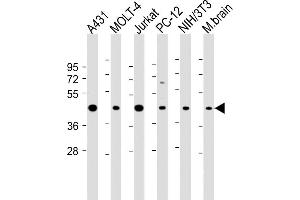 All lanes : Anti-ASS Antibody (Center) at 1:2000 dilution Lane 1: A431 whole cell lysate Lane 2: MOLT-4 whole cell lysate Lane 3: Jurkat whole cell lysate Lane 4: PC-12 whole cell lysate Lane 5: NIH/3T3 whole cell lysate Lane 6: Mouse brain lysate Lysates/proteins at 20 μg per lane.