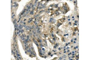 IHC analysis of LDLR using anti-LDLR antibody (ABIN7601438). (LDLR antibody  (AA 35-843))