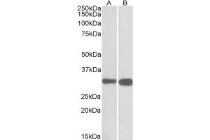 AP31565PU-N PDXP antibody staining of Mouse (A) and Rat (B) Brain lysates at 0. (PDXP antibody  (C-Term))