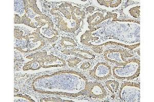 IHC analysis of HSPD1 using anti-HSPD1 antibody (ABIN7600976). (HSPD1 antibody  (AA 260-496))