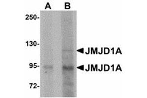 Image no. 1 for anti-Lysine (K)-Specific Demethylase 3A (KDM3A) (N-Term) antibody (ABIN478151) (KDM3A antibody  (N-Term))