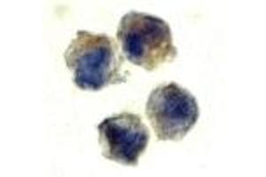 Immunohistochemistry (IHC) image for anti-Interleukin 22 Receptor (IL22R) (N-Term) antibody (ABIN1031411) (IL22R antibody  (N-Term))