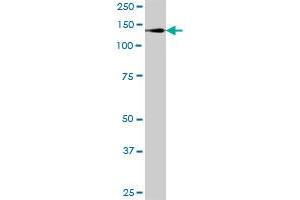 DHX29 MaxPab polyclonal antibody. (DHX29 antibody  (AA 1-1369))