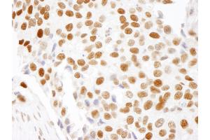 Immunohistochemistry (IHC) image for anti-High Mobility Group Nucleosome Binding Domain 1 (HMGN1) (AA 90-100) antibody (ABIN7448975)