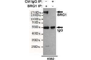Immunoprecipitation analysis of K562 cell lysates using BRG1 mouse mAb (201025). (SMARCA4 antibody)