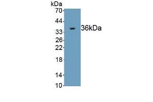 Detection of Recombinant TP53, Rat using Monoclonal Antibody to Tumor Protein p53 (P53) (p53 antibody  (AA 90-354))