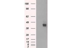 HEK293T cells were transfected with the pCMV6-ENTRY control (Left lane) or pCMV6-ENTRY BSG (Right lane) cDNA for 48 hrs and lysed. (CD147 antibody)