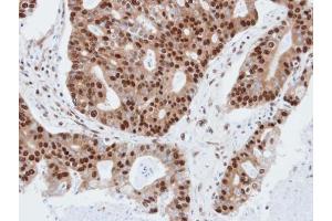 IHC-P Image Immunohistochemical analysis of paraffin-embedded human endo mitral, using PDE4C, antibody at 1:100 dilution. (PDE4C antibody)