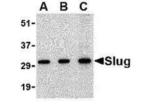 Western Blotting (WB) image for anti-SLUG (Center) antibody (ABIN2476524) (SLUG antibody  (Center))