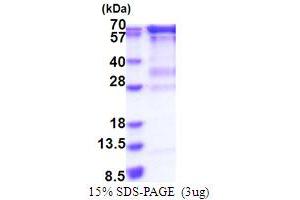 SDS-PAGE (SDS) image for RNA Guanylyltransferase and 5'-Phosphatase (RNGTT) (AA 1-597) protein (His tag) (ABIN5853868)