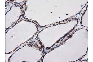 Image no. 1 for anti-Catenin (Cadherin-Associated Protein), beta 1, 88kDa (CTNNB1) antibody (ABIN1496890) (CTNNB1 antibody)