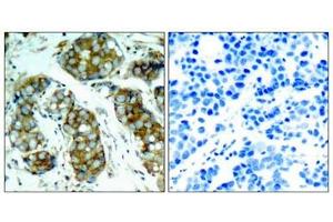 Immunohistochemistry (IHC) image for anti-Cell Division Cycle 25 Homolog A (S. Pombe) (CDC25A) (pSer76) antibody (ABIN7138695)