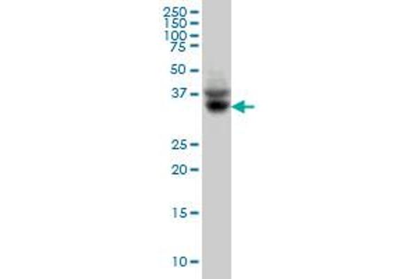 SLC35A3 antibody  (AA 61-113)
