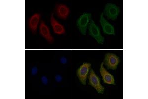 ABIN6257536 and ABIN6274704 staining Hela cells by IF/ICC.
