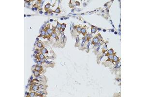 Immunohistochemistry of paraffin-embedded mouse testis using HEXA antibody (ABIN6290114) at dilution of 1:100 (40x lens).