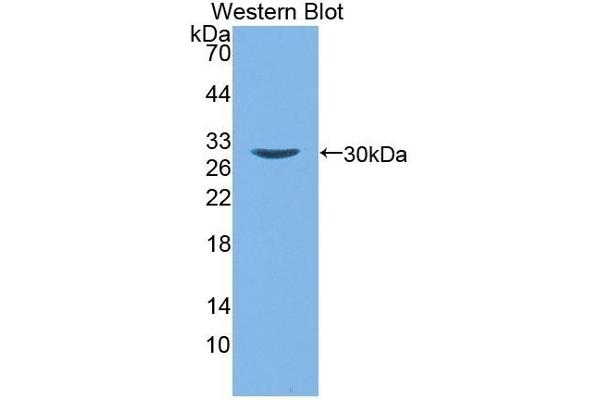 ALOX15B antibody  (AA 253-490)