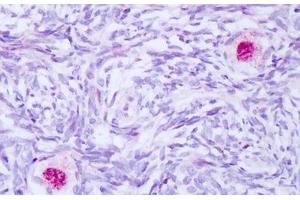 Image no. 2 for anti-BCL2-Associated Athanogene (BAG1) (AA 112-161) antibody (ABIN6749782) (BAG1 antibody  (AA 112-161))
