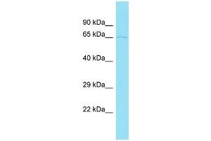 Western Blotting (WB) image for anti-ENTH Domain Containing 2 (ENTHD2) (N-Term) antibody (ABIN2774498) (ENTHD2 antibody  (N-Term))