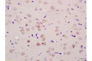 Formalin-fixed and paraffin embedded rat testis tissue labeled with Anti-SLCO1C1/OATP-F Polyclonal Antibody, Unconjugated (ABIN1387638) at 1:200 followed by conjugation to the secondary antibody and DAB staining (SLCO1C1 antibody  (AA 401-500))