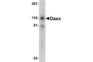 Western blot analysis of Daxx in 293 whole cell lysate with Daxx antibody at 1ug/ml. (DAXX antibody)