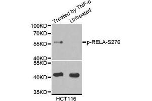 Western blot analysis of extract from Hela cells using Phospho-RELA-S276 antibody. (NF-kB p65 antibody  (pSer276))