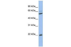 Western Blotting (WB) image for anti-Nuclear Receptor Subfamily 0, Group B, Member 1 (NR0B1) (Middle Region) antibody (ABIN2777385)