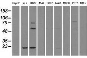 Western blot analysis of extracts (35 µg) from 9 different cell lines by using anti-CD4 monoclonal antibody. (CD4 antibody)