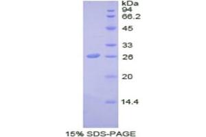 SDS-PAGE analysis of Human SDF4 Protein.