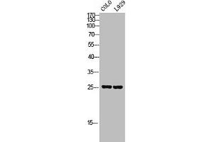 Western Blot analysis of COLO L929 cells using SRp20 Polyclonal Antibody (SRSF3 antibody  (C-Term))