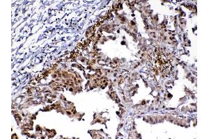 IHC analysis of MED9 using anti-MED9 antibody . (MED9 antibody  (AA 55-146))