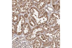 Immunohistochemical staining (Formalin-fixed paraffin-embedded sections) of human kidney with MACC1 polyclonal antibody  shows moderate cytoplasmic positivity in cells in tubules. (MACC1 antibody)
