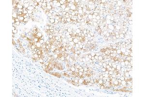 Immunohistochemistry (IHC) image for anti-Fibrinogen-Like 1 (FGL1) (AA 18-312) antibody (ABIN7453972) (Recombinant FGL1 antibody  (AA 18-312))
